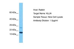 KLLN Rabbit anti-Human, Polyclonal, Novus Biologicals 0.1ml; Unconjugated:Antibodies,